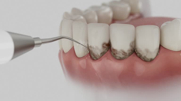 Trusted Teeth Cleaning And Checkup service in Pine Prairie, LA - Dentist Open Now